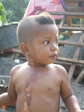 Seorang bocah laki-laki warga Kaligatuk, Srimulyo, Piyungan, Bantul terluka di bagian dada sampai...