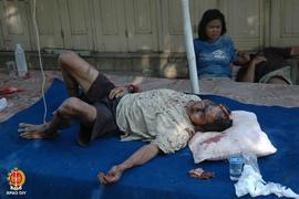 Kondisi pasien gempa bumi yang dirawat di depan Rumah Sakit PKU Muhamadiyah Bantul, tampak seoran...